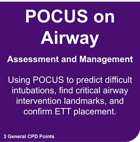 POCUS for Airway POCUS for Airway